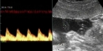View the album 25 Week Scan